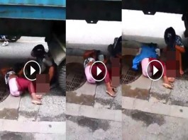 โคตรสุดยอด!! สาวทอมขาขาดครึ่งท่อนกัดฟันไม่ร้องซักนิด แถมถอดเสื้อคลุมให้แฟนที่นอนเจ็บข้างๆ แบบไม่สนชีวิตตัวเอง (คลิป)