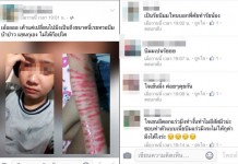 ชาวเน็ตงง!! โลกเราถึงจุดนี้ได้ไง…จุดที่ลิปสติกเขียนแขนแต่คนเชื่อว่าเลือด