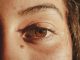 กล้ามเนื้อตาอ่อนแรงอันตรายไหม