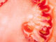 Bacterial Vaginosis คืออะไร ? ผู้หญิงต้องอ่านเพื่อเฝ้าระวัง Bacterial Vaginosis คืออะไร ผู้หญิงต้องอ่านเพื่อเฝ้าระวัง