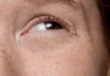 ผ่าตัดแก้ไขกล้ามเนื้อตาอ่อนแรง