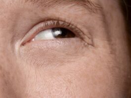 ผ่าตัดแก้ไขกล้ามเนื้อตาอ่อนแรง